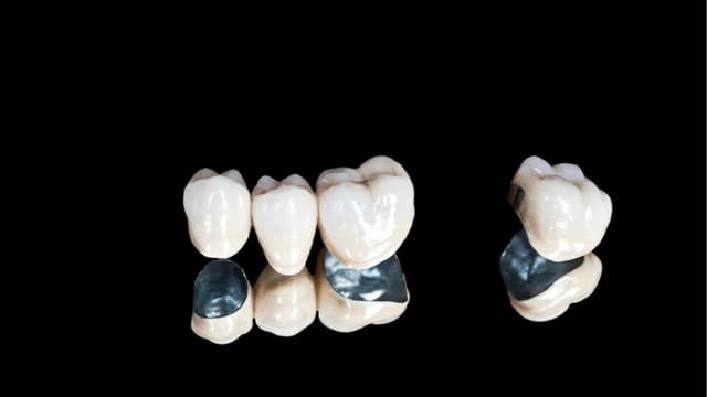 مزوتراپی مو با برند فیوژن (هر جلسه) دکتر فرزانه رضاقلی زاده عمران