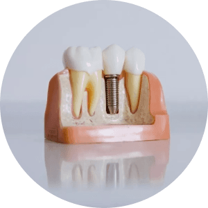 پروتز های دندانی